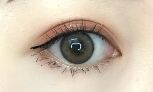 北京八大處歸來磨骨綜合信息，醫(yī)生技術(shù)評價與術(shù)后分享