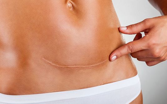 【北京唇裂修復(fù)哪家醫(yī)院好？專家推薦權(quán)威醫(yī)療機(jī)構(gòu)】