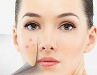 廈門哪家醫(yī)院墊鼻子好？專家推薦的Top5廈門墊鼻子好醫(yī)院