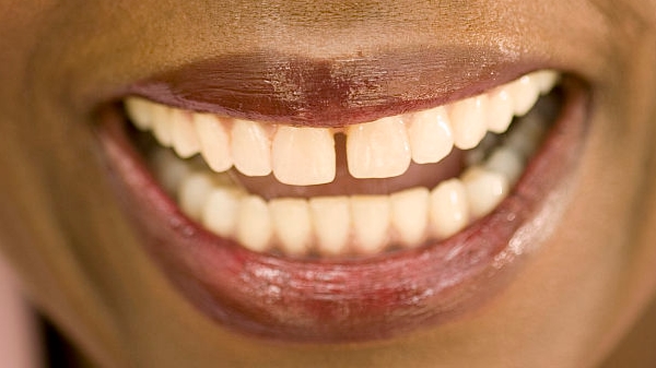 2023揭陽隆下巴整形口碑TOP10強醫(yī)生(陳祥、趙學(xué)燕、李鐵軍技術(shù)好、還靠譜！)