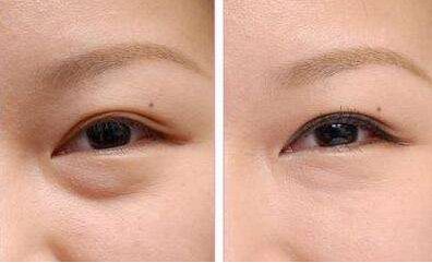 洛陽有減肥醫(yī)院哪家好？瘦身專家推薦幫您選擇洛陽最好的減肥醫(yī)院