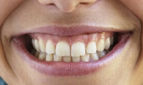 2023鄭州潤白顏玻尿酸醫(yī)生排名榜(米杰、江菊、尹趙心避坑不踩雷)