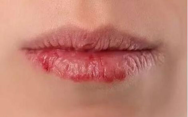 2023哈爾濱激光e光祛斑權(quán)威醫(yī)生評分TOP10強(王剛、湯張洪、姚盛雷資料已備好供您選擇！)