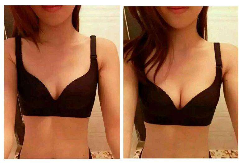 2023義烏生長(zhǎng)紋填充面部皺紋正規(guī)醫(yī)生十強(qiáng)(王馨婉、張喆、高俊明技術(shù)挺靠譜)