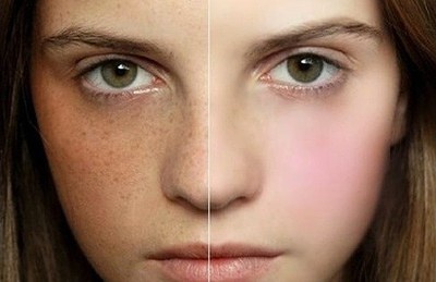 2023中山魚尾紋打玻尿酸正規(guī)醫(yī)生上榜TOP10(陳瑩、楊碩、田治國口碑不錯的醫(yī)生，快來選！)