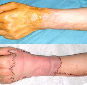 米德傲吸脂技術(shù)優(yōu)勢(shì)分析：醫(yī)生評(píng)價(jià)、收費(fèi)信息先解密！杭州藝星權(quán)威專(zhuān)家！