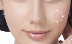 2023貴州激光修復(fù)靜態(tài)紋口碑專家(梁安裕、張小玲、陳璐一起來瞧瞧實力高低~)