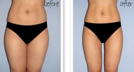 2023邯鄲音波拉皮面部除皺排行榜前10強的專家(高樹英、史慧萍、劉珠蓮收費不貴)