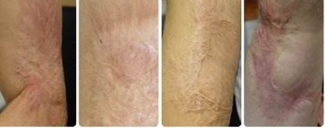 南京去紅血絲醫(yī)院專業(yè)推薦：哪家醫(yī)院技術(shù)高效、費(fèi)用合理？