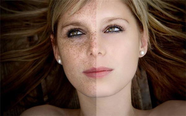 2023東莞臉部祛黑痣大型醫(yī)生口碑排名(黃利、韓勇、黃尾全口碑、價(jià)格揭秘)