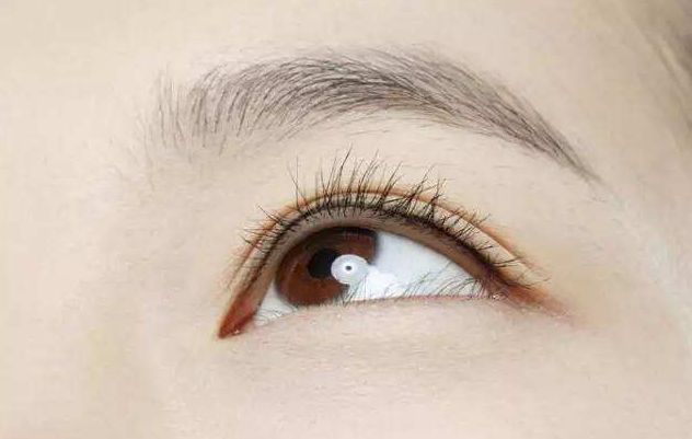 杭州祛眼袋手術(shù)哪家醫(yī)院好？詳細(xì)醫(yī)院排名及患者口碑調(diào)查