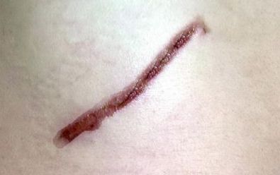 探尋開封市美容醫(yī)院的排名與口碑，哪家值得信賴？