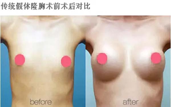 溫州雍禾醫(yī)院信譽如何？求推薦占家佳醫(yī)生植發(fā)效果如何？或溫州雍禾醫(yī)院口碑怎么樣？哪位醫(yī)生適合占家佳植發(fā)