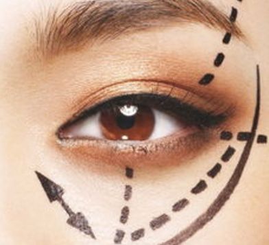 蘭州眼睛美容醫(yī)院哪家好？揭秘蘭州市最受歡迎的眼睛美容醫(yī)院排行榜！