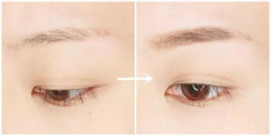 2023西安注射膠原蛋白除皺強(qiáng)榜前十強(qiáng)的醫(yī)生(王磊、朱瑩、閆淑強(qiáng)烈來襲)