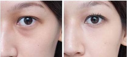 杭州哪家醫(yī)院做狐臭手術(shù)好且靠譜？