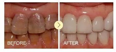 西安畫美楊萬忠鼻部整形效果解析！楊萬忠醫(yī)生簡介及收費(fèi)準(zhǔn)則！