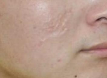 合肥整容醫(yī)生綜合排名TOP5，獨(dú)具經(jīng)驗(yàn)與在線咨詢服務(wù)