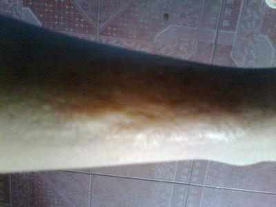 2023紹興耳軟骨隆鼻手術(shù)權(quán)威醫(yī)生榜單前十名(徐榮俊、方倫磊、謝劍入圍前四)