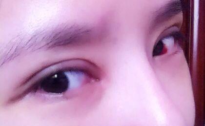 2023重慶做豐唇珠權(quán)威專家上榜前10名(吳偉、薛斌、趙小英反饋超級(jí)好)