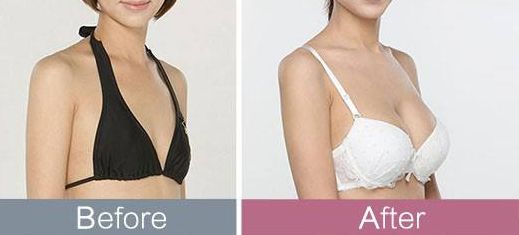 平頂山哪家醫(yī)院治療疤痕效果好且受用戶好評？