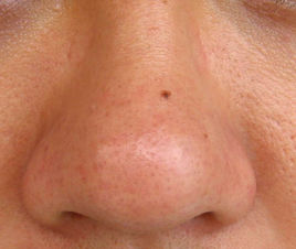 2023廣安線雕動態(tài)細紋前十位醫(yī)生排行榜(王靜、范偉、沙新力口碑出圈實力吸粉)