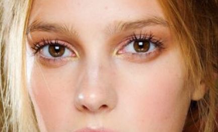 上海淡化雀斑的去哪家好？解析專家推薦的十大有效產(chǎn)品與方法