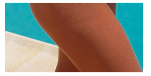 西安去雀斑醫(yī)院排名及用戶口碑評價(jià)，哪家醫(yī)院效果更好？