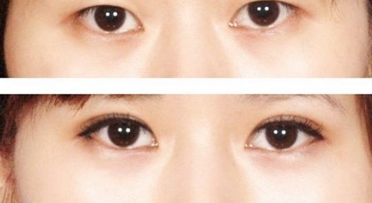 浙江激光祛斑醫(yī)院排名及評價，哪家好？