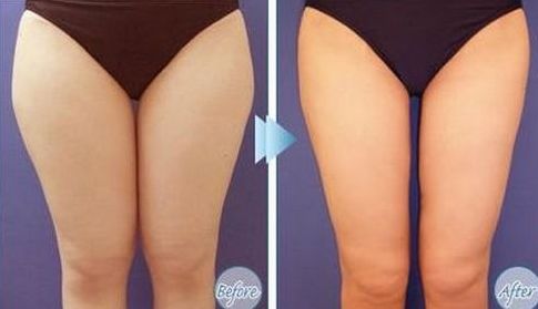 如何選擇最適合您的除腋臭治療醫(yī)院？全國(guó)哪家醫(yī)院好？