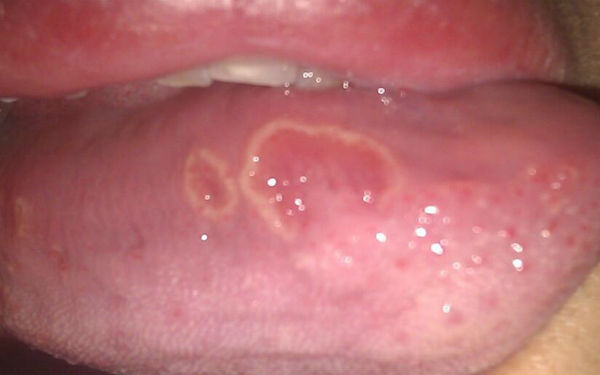 2023上海乳頭溝修復(fù)前10專家(蔣春意、王濤、李青峰熱門TOP盤點)