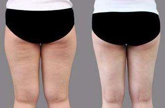 菏澤市整形醫(yī)院哪家好？排名榜單發(fā)布