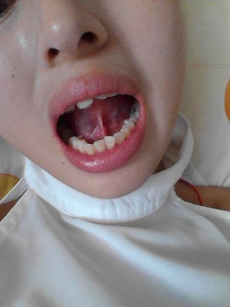 2023寧波botox除皺針權(quán)威專家排行前10強(qiáng)(茅來發(fā)、龔全康、田柏怡技術(shù)特色分享！)