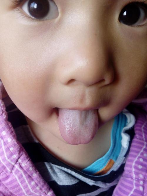 2023深圳光纖溶脂減腰部專家評(píng)價(jià)前10位(湯月碧、賈月、李英榜三強(qiáng)竟被他們拿下！)