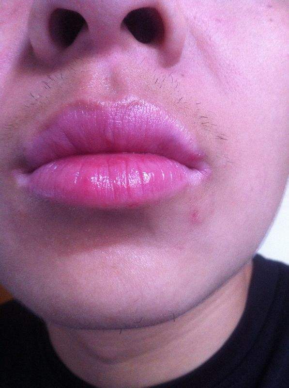 2023南寧玻尿酸面頰除皺榜上前10專家(陳麗娟、凌日龍、邢文明個個實力強橫)