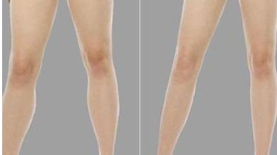 南京埋線醫(yī)院哪家好？權(quán)威專家推薦五家頂級(jí)醫(yī)院！