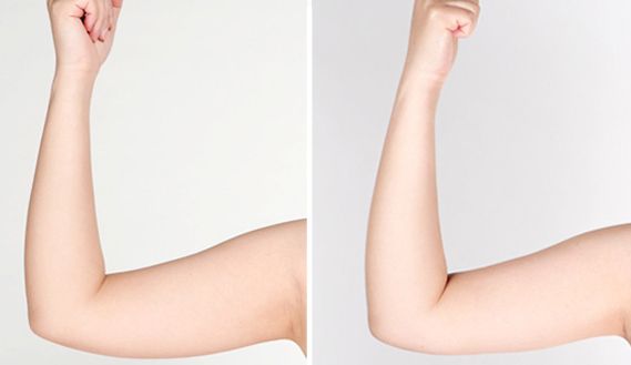 貴陽有哪些專業(yè)治療痘印痘坑的醫(yī)院值得推薦？