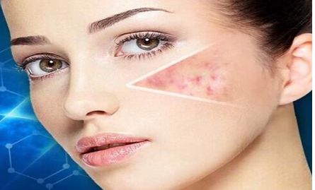 南京哪家醫(yī)院做埋線雙眼皮效果好？