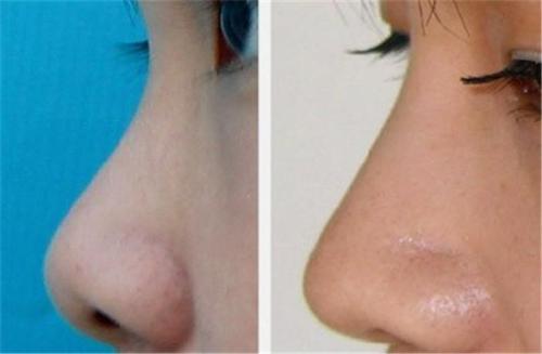 2023內(nèi)江超聲筆去下頜角排行榜前十名的專家(劉培、羊一華、陳科等雙雙上榜)