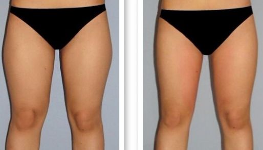 濟(jì)南祛痘哪家醫(yī)院技術(shù)好？選擇哪家醫(yī)院更靠譜？