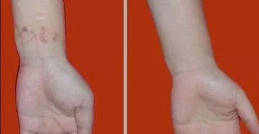 杭州哪家醫(yī)院看喉嚨好？排名最好的專業(yè)醫(yī)院推薦