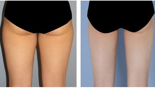 重慶康美整形美容醫(yī)院門診有用戶好評嗎？醫(yī)生資料和價格表全面解讀