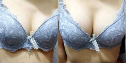 上饒雙眼皮手術哪家醫(yī)院好？專業(yè)排名推薦！