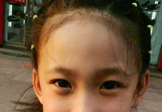 蘇州激光祛疤哪家醫(yī)院好？選擇激光祛疤專家，恢復(fù)美肌無憂！