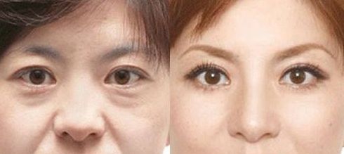 成都做乳暈漂紅哪家好？乳暈漂紅的價(jià)格、效果、方法哪種最合適？