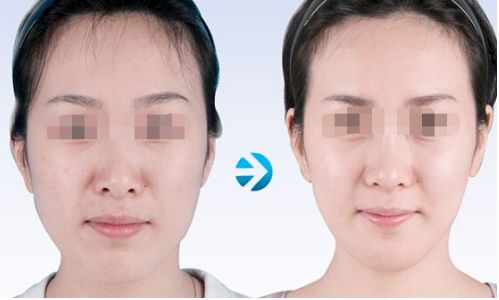 云南雙眼皮手術(shù)有哪些優(yōu)質(zhì)醫(yī)院值得推薦？