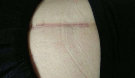 杭州市哪家醫(yī)院的玻尿酸注射技術(shù)更好？附醫(yī)生資料及整形科點(diǎn)評(píng)