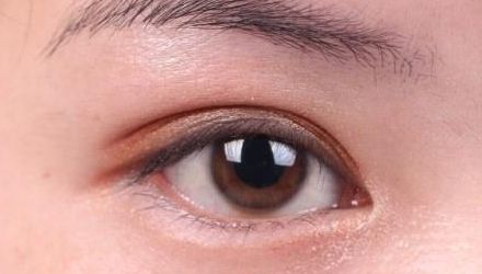 蘇州雙眼皮修復醫(yī)院排名及口碑，哪家醫(yī)院修復效果最好？