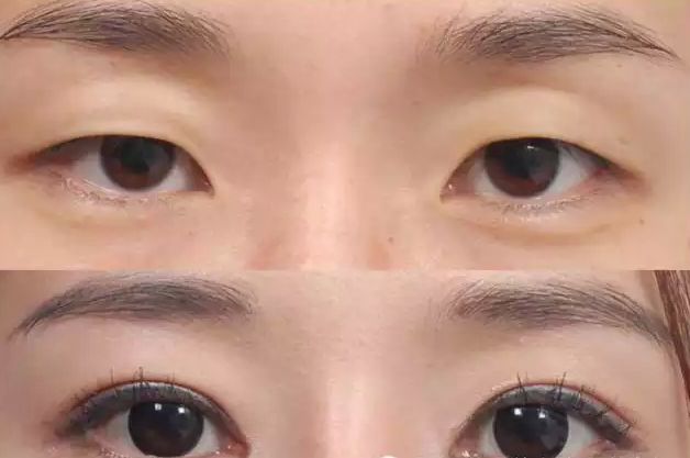 2023恩施脂肪整形豐胸專家排名榜(趙東升、倪彬、王崗各個都是人氣之選)