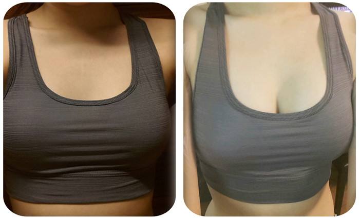 2023石家莊填充祛皺專家TOP10強榜單(鄒慧嫻、劉桂臻、趙小忠趕緊收藏起來)